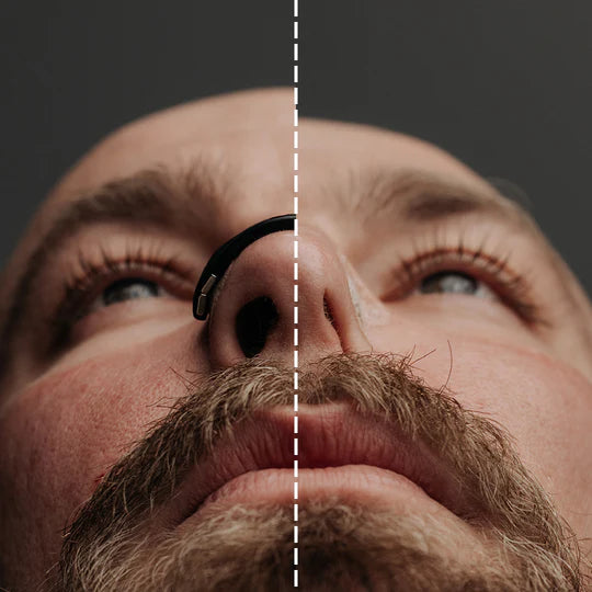 Proporciona soporte para la estructura nasal